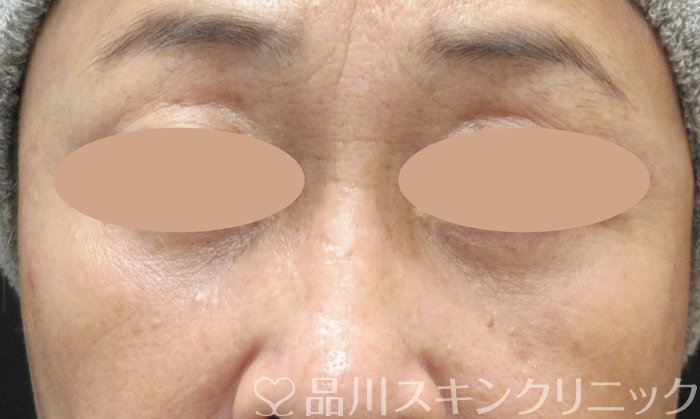 症例NO.73861のAFTER写真