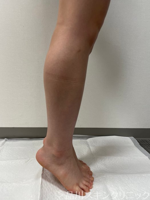 症例NO.73247のBEFORE写真