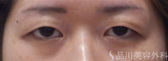 症例NO.16736のBEFORE写真