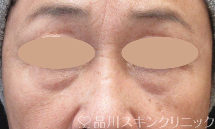 症例NO.73861のBEFORE写真