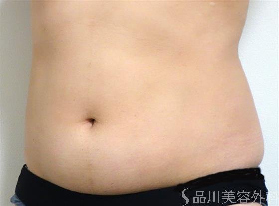 症例NO.35165のBEFORE写真