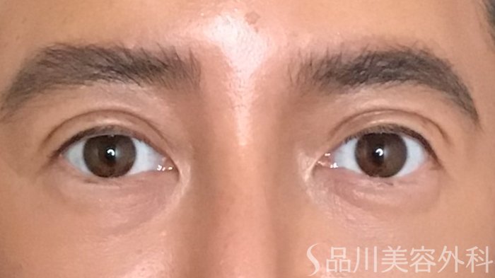 症例NO.65007のAFTER写真