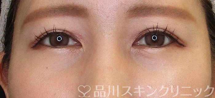 症例NO.66972のAFTER写真