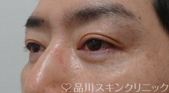 症例NO.70784のAFTER写真