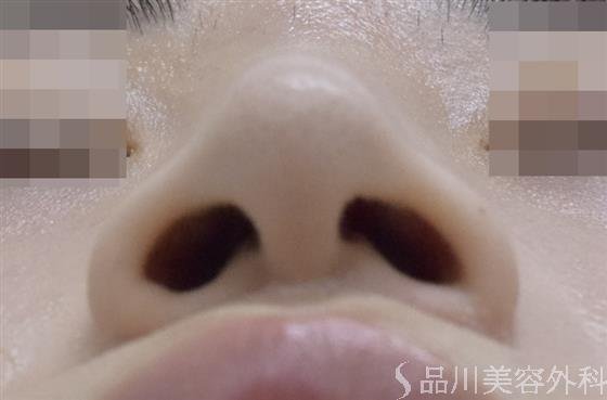 症例NO.50388のBEFORE写真