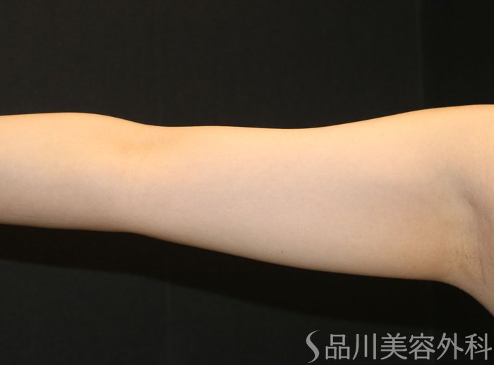 症例NO.71629のAFTER写真