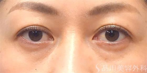 症例NO.20836のAFTER写真