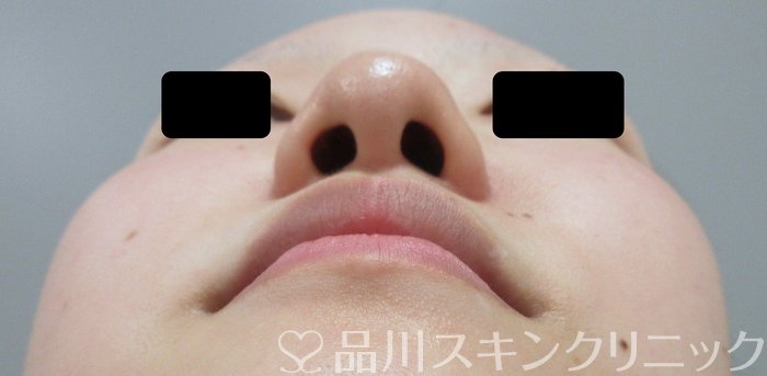 症例NO.73980のAFTER写真
