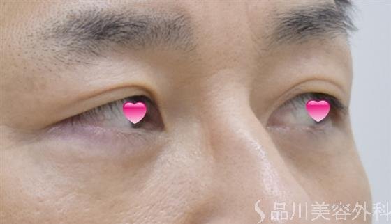 症例NO.50256のAFTER写真