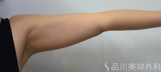 症例NO.47502のBEFORE写真