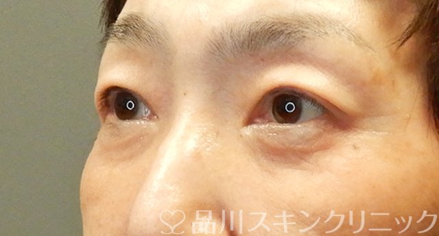症例NO.66686のAFTER写真