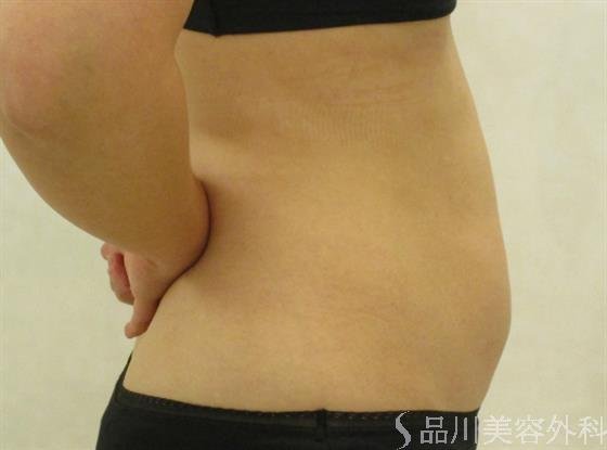 症例NO.43231のBEFORE写真