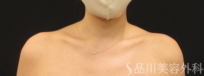 症例NO.71027のBEFORE写真