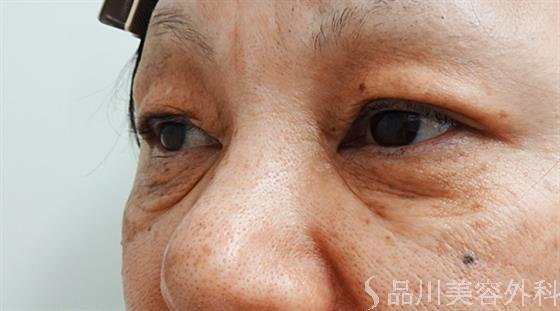症例NO.30262のBEFORE写真