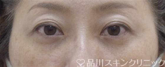 症例NO.53599のAFTER写真