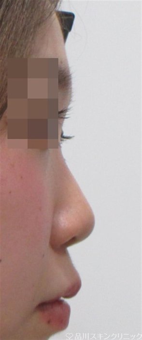 症例NO.27138のBEFORE写真