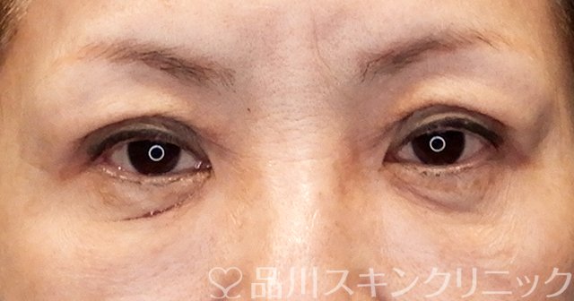 症例NO.65484のAFTER写真