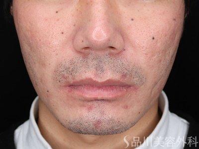症例NO.70227のBEFORE写真