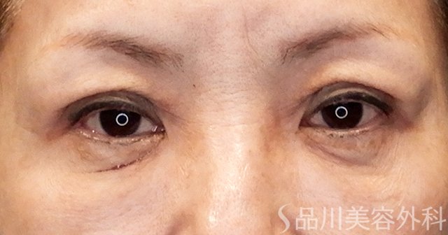 症例NO.65484のAFTER写真