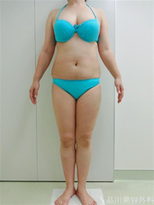 症例NO.26701のBEFORE写真