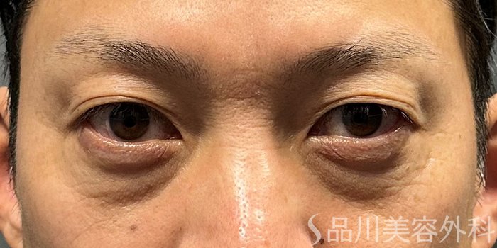 症例NO.70304のBEFORE写真