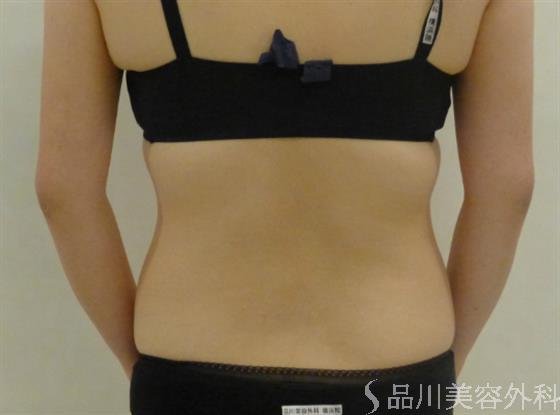 症例NO.41065のBEFORE写真