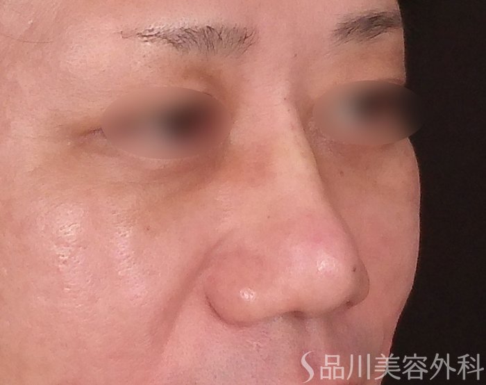 症例NO.70255のAFTER写真