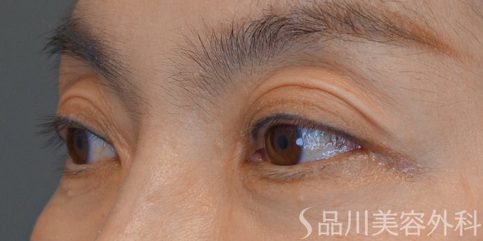 症例NO.73889のBEFORE写真
