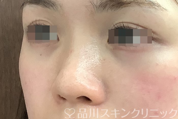 症例NO.63002のBEFORE写真