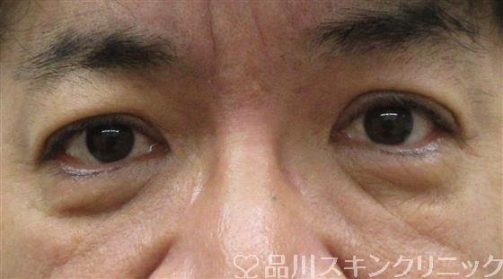 症例NO.59979のBEFORE写真