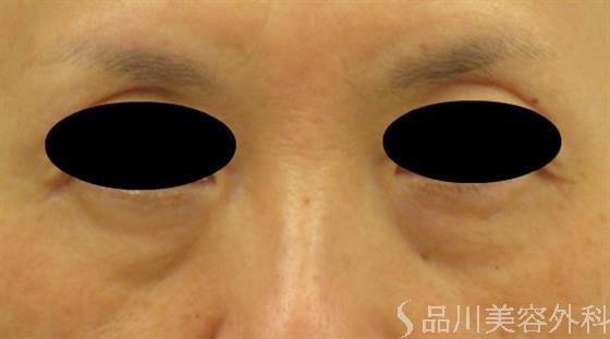 症例NO.47824のBEFORE写真