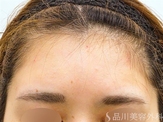 症例NO.50726のAFTER写真