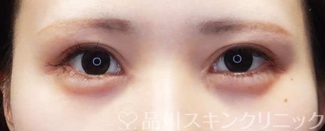 症例NO.73072のAFTER写真