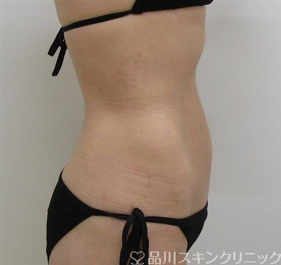 症例NO.36118のAFTER写真