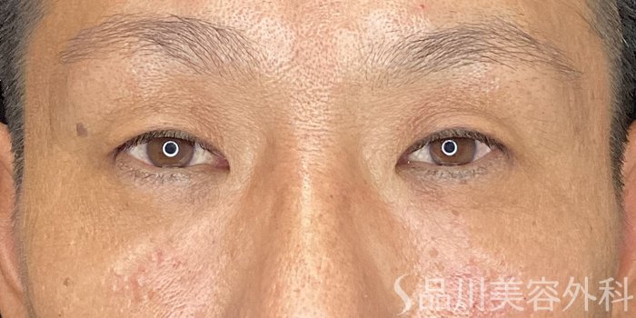 症例NO.72040のAFTER写真