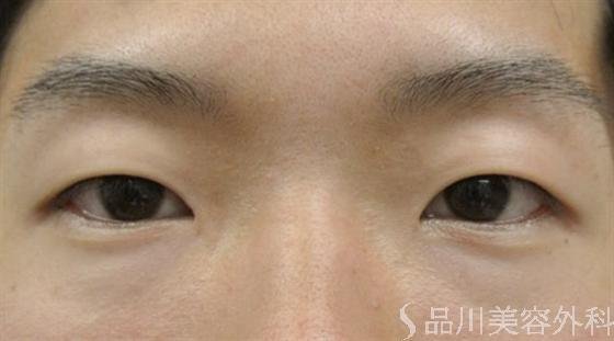 症例NO.16218のBEFORE写真