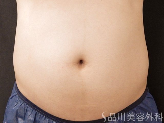 症例NO.73749のBEFORE写真