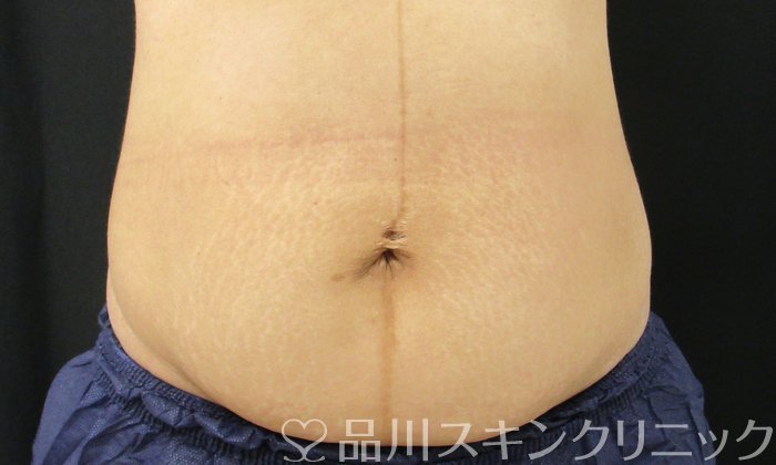 症例NO.74659のBEFORE写真