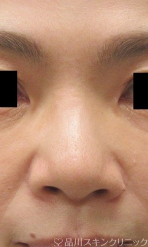 症例NO.69373のBEFORE写真