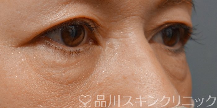 症例NO.71191のBEFORE写真