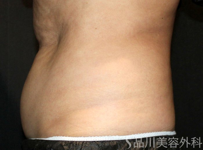 症例NO.73834のBEFORE写真