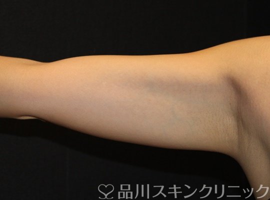 症例NO.71926のBEFORE写真