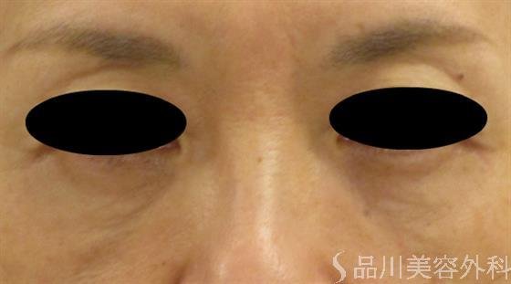 症例NO.47824のAFTER写真