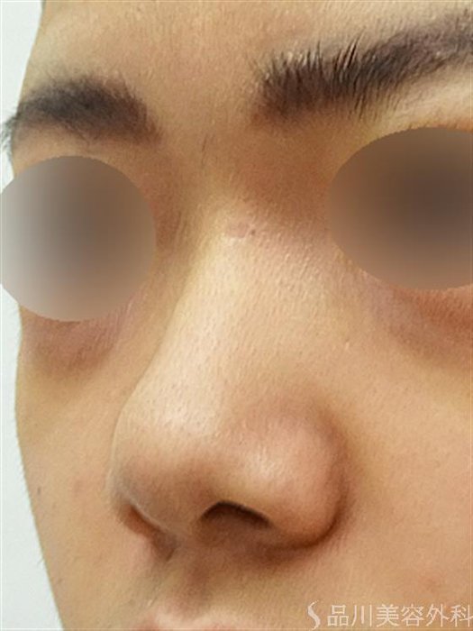 症例NO.42650のBEFORE写真