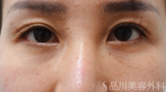 症例NO.70207のAFTER写真