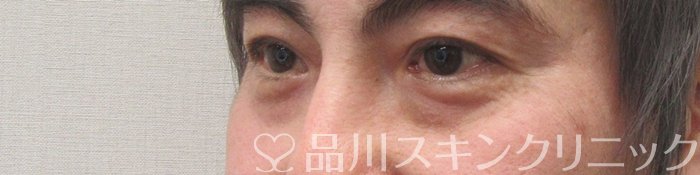 症例NO.70224のBEFORE写真