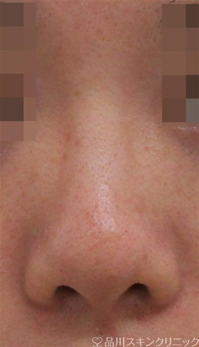 症例NO.37720のBEFORE写真