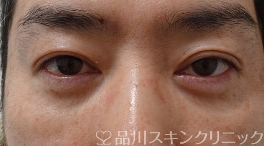 症例NO.70784のAFTER写真