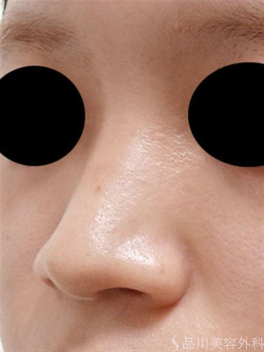 症例NO.54273のBEFORE写真