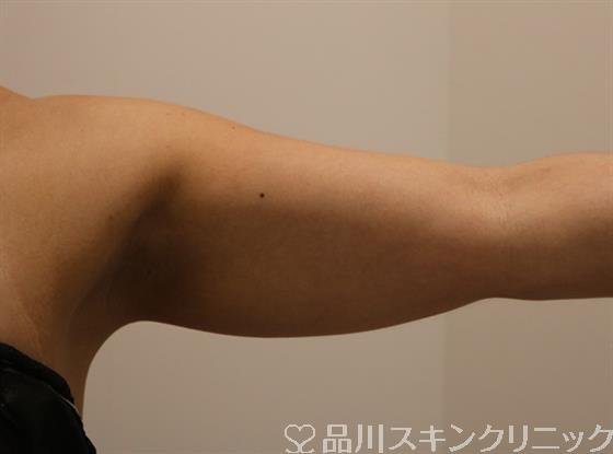 症例NO.43808のBEFORE写真